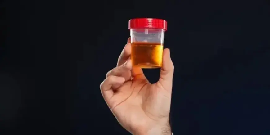 Hati-hati! Ciri-ciri Darah Tinggi yang Muncul pada Urine yang Perlu Diwaspadai